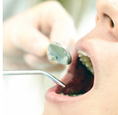 定期健診　予防歯科